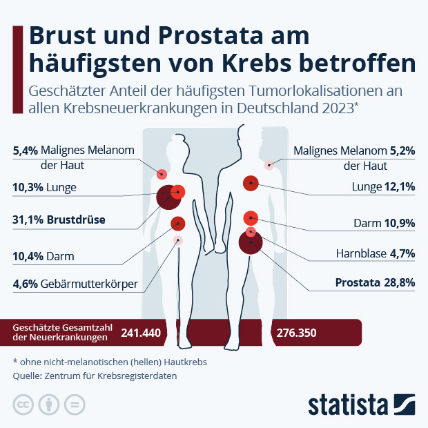 Welche Krebsart tritt am häufigsten auf? - Infografik